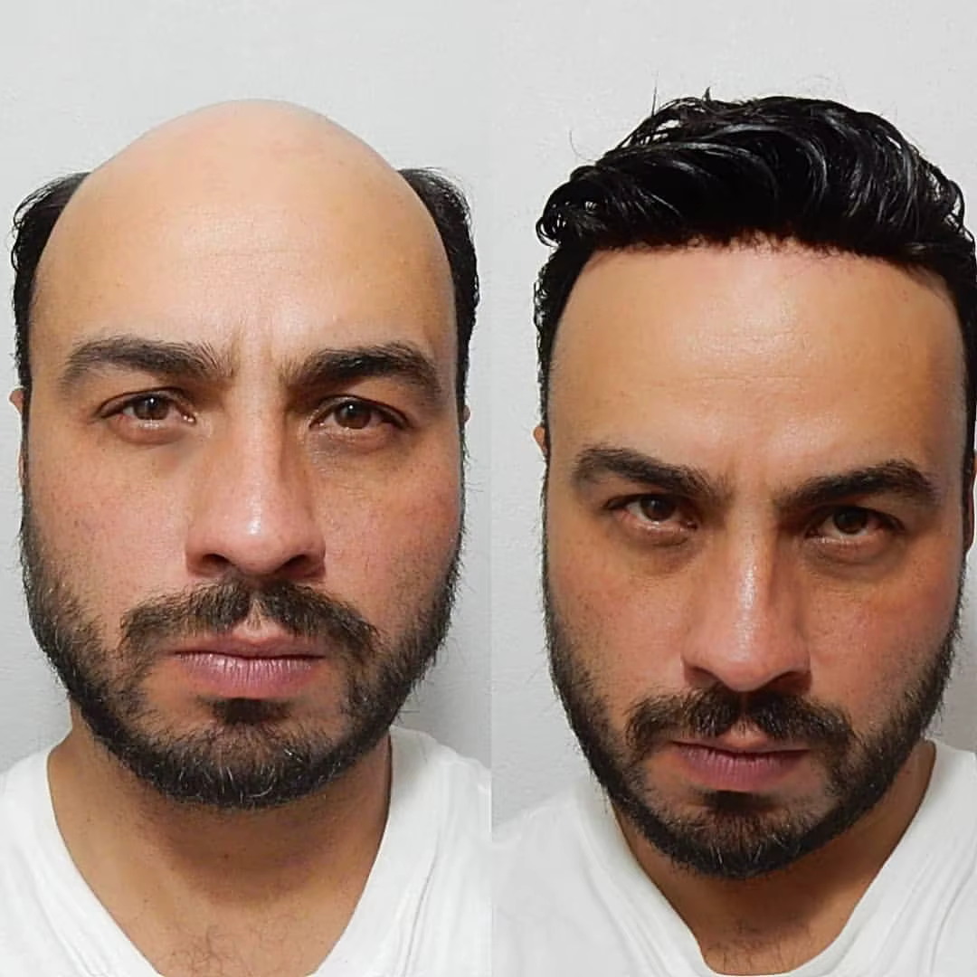 Prothèse de cheveux humains en PU à peau fine pour hommes,proteses de cabelo humano masculino toupet