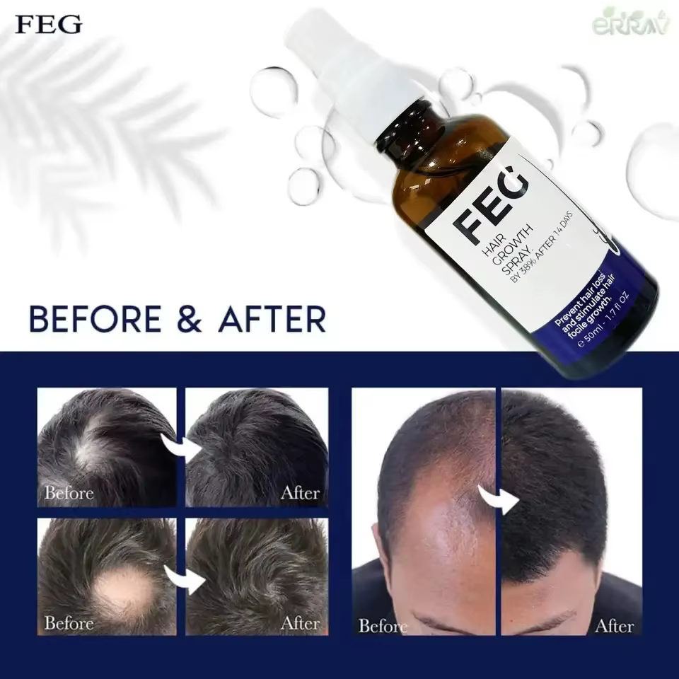 FEG-Huile de Soins Capillaires Biologique, pour Cheveux Longs, pour la Maison, Rotterdam y, 50ml