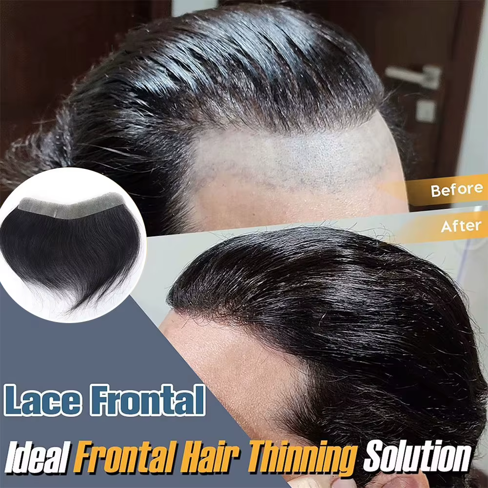 Cheveux humains naturels front délié toupet hommes prothèse capillaire peau mince postiche système de remplacement Remy