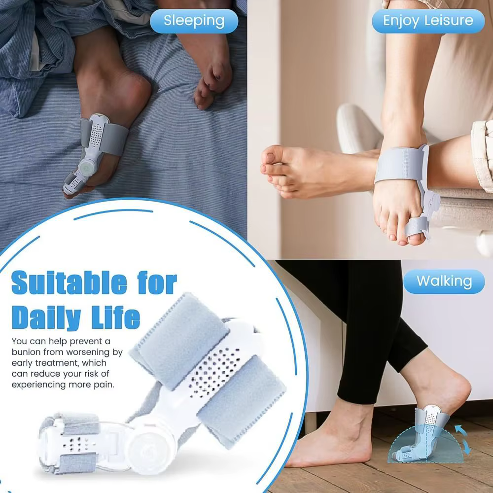 Correcteur d'hallux valgus à bouton réglable, conception orthopédique, orthèse pour hallux valgus, redresseur de doigts séparés, séparateur d'orteils