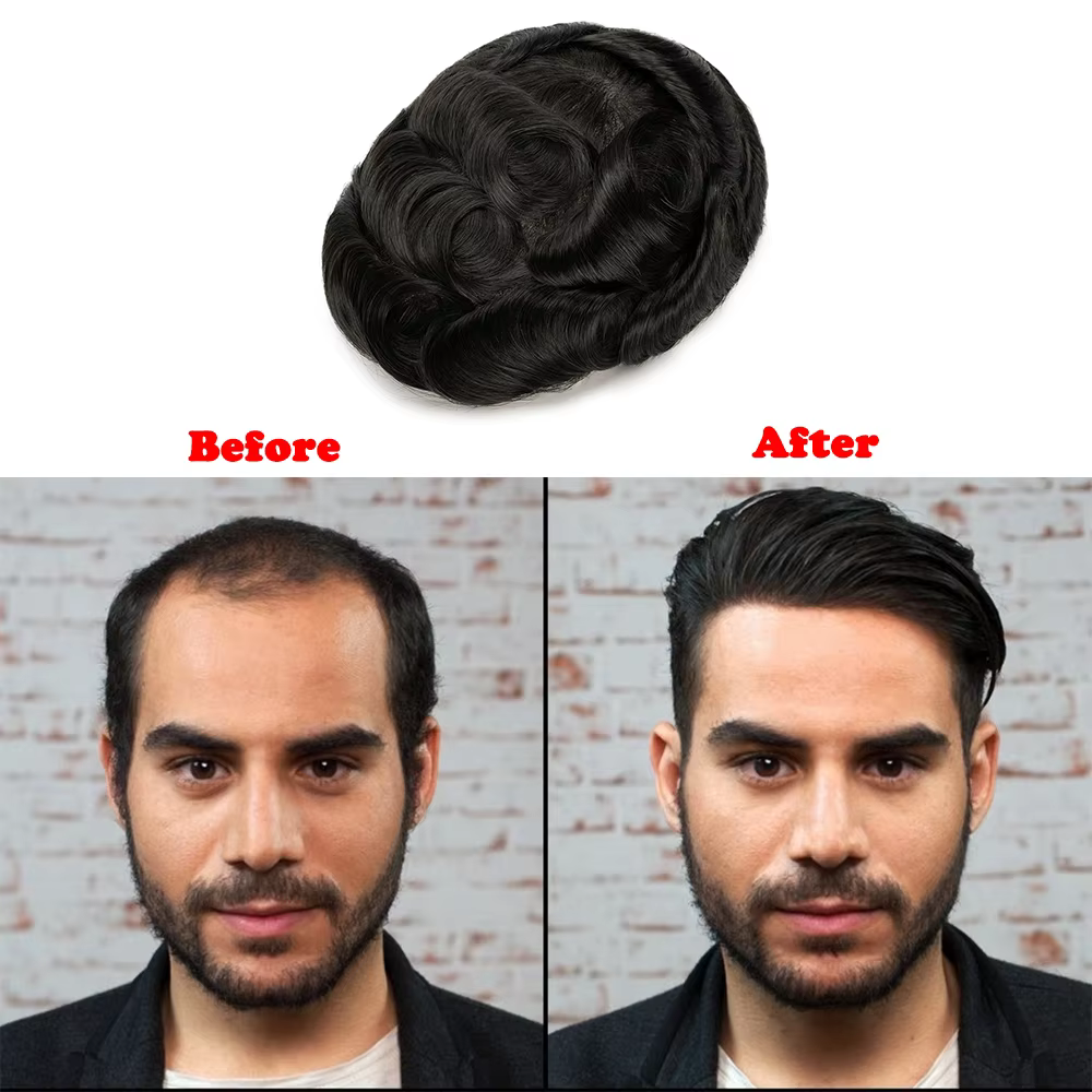 Prothèse capillaire pour homme