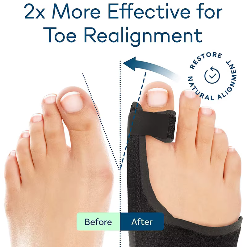 Une paire de correcteurs d'orteils, orthèses, ajusteurs osseux, protecteurs, correcteurs de hallux valgus, outils orthopédiques et d'entretien