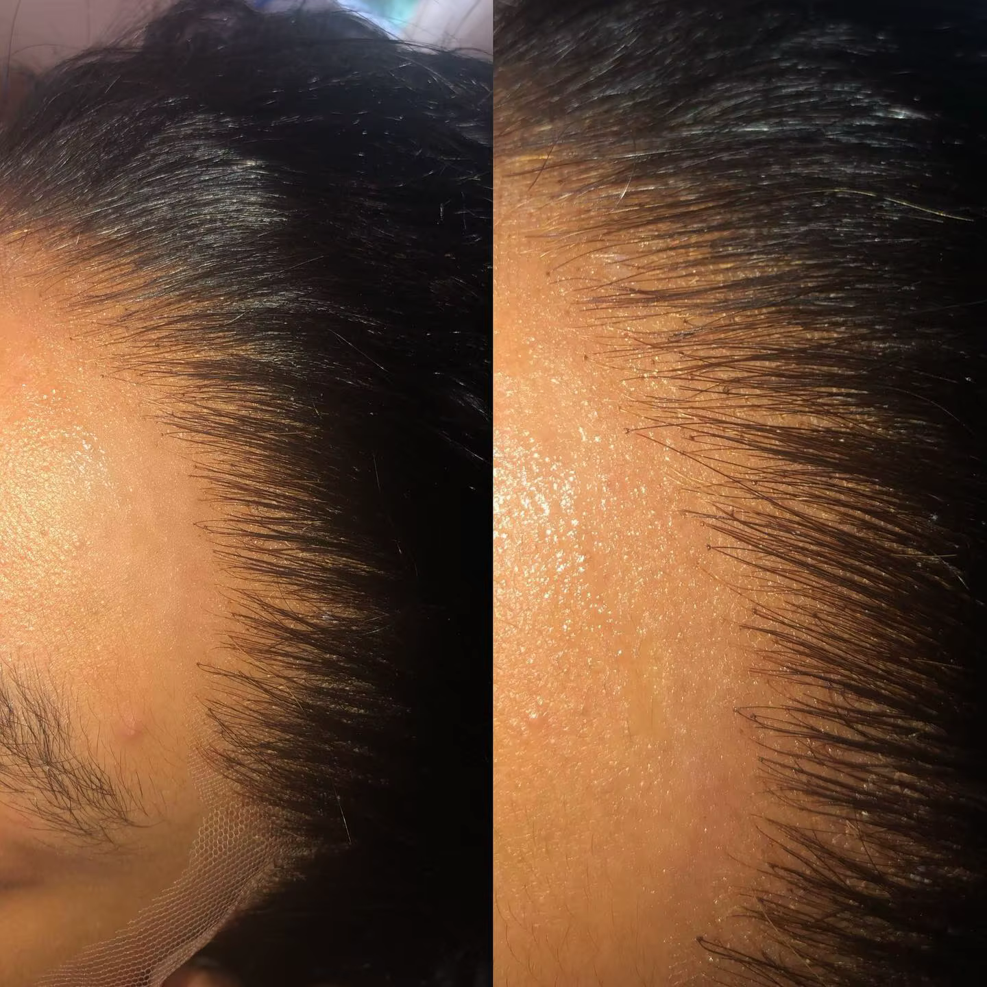 Perruque sans colle ultra couvertes Water Wave